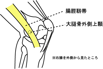 腸脛靱帯