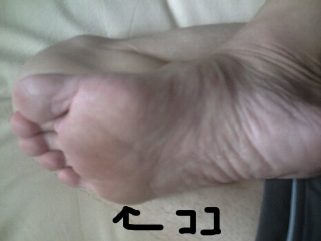 小指 の 付け根 痛い 足 足の付け根が痛い：医師が考える原因と対処法｜症状辞典