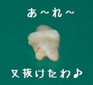 歯DSC_0232